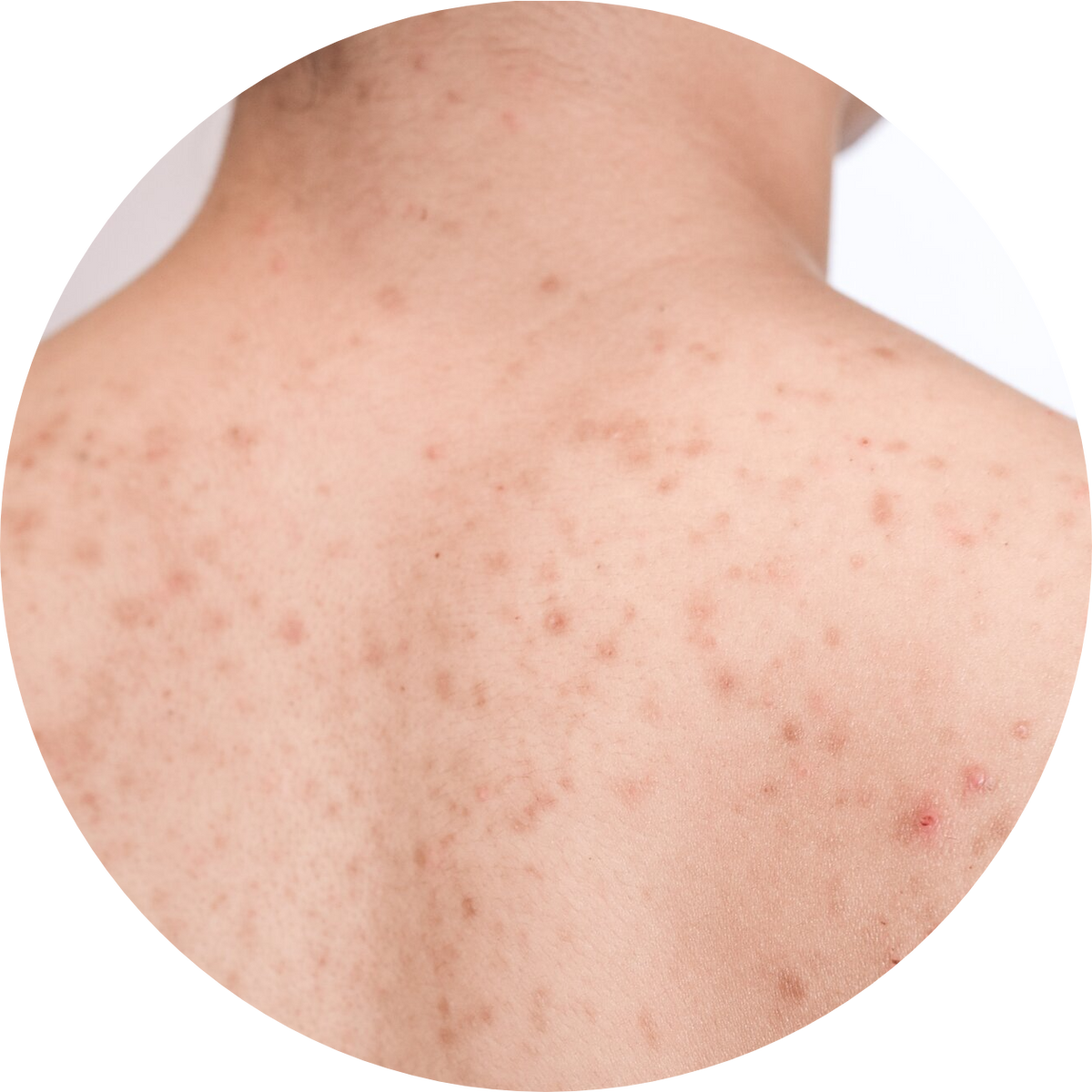 itchy-rashes